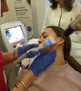 zena kod dermatologa tretirana PIXEL RF laserom