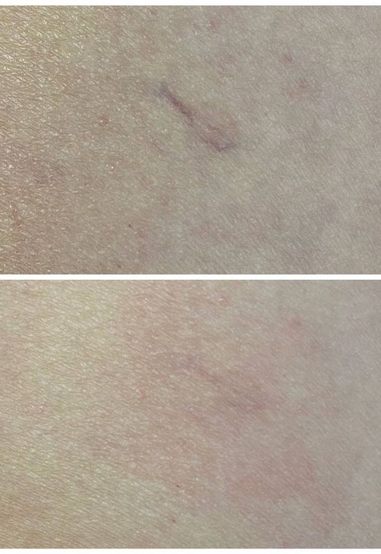 diva laser centar