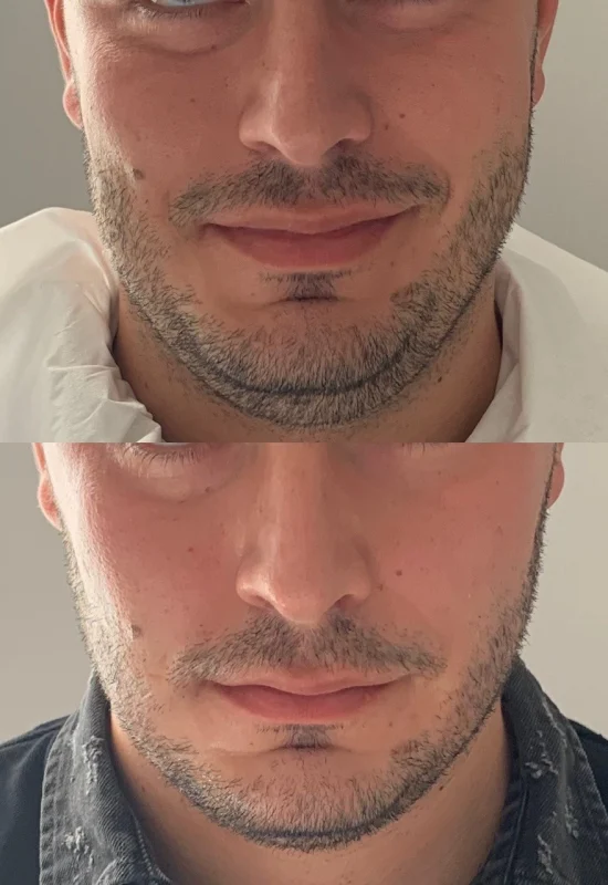 diva laser centar